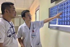 Bác sỹ kiểm tra phim chụp cho người bệnh. (Nguồn: Bệnh viện Hữu nghị Việt Đức)