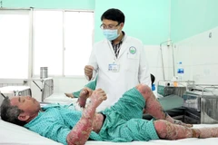 Bác sỹ Nguyễn Vũ Hoàng, Phó Trưởng khoa Lâm sàng 2 - Bệnh viện Da liễu Thành phố Hồ Chí Minh thăm khám cho bệnh nhân. (Ảnh: TTXVN)