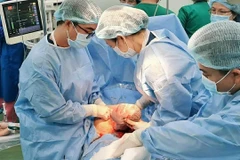 Các bác sỹ Bệnh viện Hùng Vương và Bệnh viện Nhi đồng Thành phố phối hợp phẫu thuật lấy thai an toàn cho bệnh nhi. (Ảnh: TTXVN)