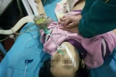 Các bác sỹ đang cấp cứu cho Ngọc Ngọc. (Nguồn: Chinadaily)