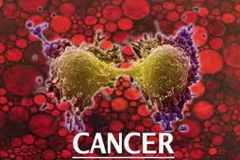 Tìm ra phương pháp xét nghiệm mới phát hiện sớm ung thư 