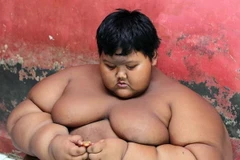 Cậu bé Arya Permana. (Nguồn: digidunia.com)