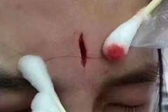 Vợ chồng giận dữ dùng iPad tấn công nữ tá