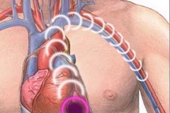 Ảnh chỉ có tính minh họa. (Nguồn: Internet)