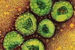 Virus corona. (Nguồn: its-interesting.com)