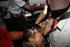 Thiếu tướng Khattiya Sawasdipol bị bắn trọng thương. (Nguồn: Reuters)