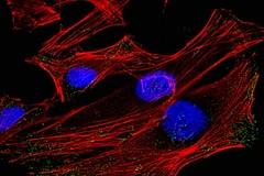 Ảnh chỉ có tính minh họa. (Nguồn: Internet)