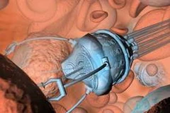 Ảnh chỉ có tính minh họa. (Nguồn: Internet)