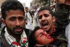 Các vụ đụng độ tại Yemen đã khiến ít nhất 30 người thiệt mạng và khoảng 200 người bị thương. (Nguồn: Getty Images)