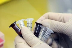 Kiểm tra các mẫu xét nghiệm virus H7N9 tại trung tâm Kiểm soát bệnh dịch ở thủ đô Bắc Kinh. (Nguồn: AFP/TTXVN)