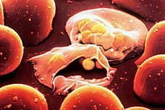 Ảnh chỉ có tính minh họa. (Nguồn: Internet)