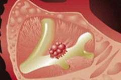 Ảnh chỉ có tính minh họa. (Nguồn: Internet)