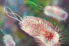 Vi khuẩn Ecoli. (Nguồn: Internet)