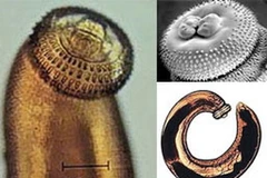 Giun đầu gai. (Nguồn: Internet)