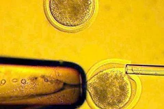 Tế bào gốc từ phôi người. (Nguồn: telegraph.co.uk)