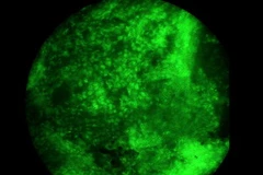 Hình ảnh thu được từ chiếc camera ứng dụng công nghệ nano. (Nguồn: futurity.org)