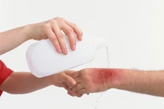 Ảnh chỉ có tính minh họa. (Nguồn: Internet)