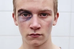 [Photo] Những dấu hiệu cho thấy con bạn đang bị tổn thương