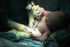 Ảnh minh họa (Nguồn: hoanmydanang.com)