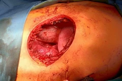 (Ảnh: TTXVN phát)