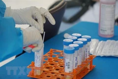 Thành phố Hồ Chí Minh tổ chức xét nghiệm diện rộng tầm soát COVID-19. (Ảnh: TTXVN)