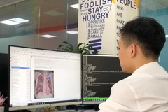 Chuyên gia AI của VinBrain đang sử dụng NVIDIA DGX A100 để đào tạo mô hình AI chẩn đoán bệnh lao. (Nguồn: Vingroup)