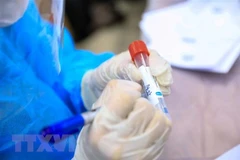 Lấy mẫu xét nghiệm SARS-CoV-2. (Ảnh: Thành Đạt/TTXVN)