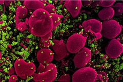 (Nguồn: european-biotechnology.com)