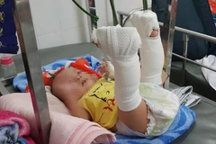 Thành phố Hồ Chí Minh: Khởi tố người đàn ông bạo hành con ruột