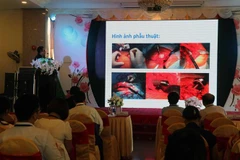 Chuyên đề Kỹ thuật thay khớp háng tại Bệnh viện Phong - Da liễu Trung ương Quy Hòa tại hội nghị. (Ảnh: Phạm Kha/TTXVN.)