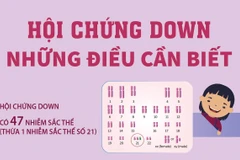Những điều cần biết về hội chứng Down.