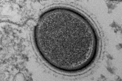 Loại virus mới được phát hiện. (Nguồn: AFP)