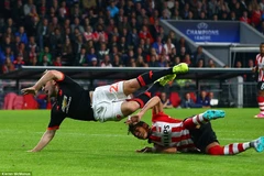 Pha bóng dẫn đến chấn thương của Luke Shaw. (Nguồn: DM)