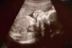 Xôn xao dư luận vụ bé gái mang thai vì bị cha dượng cưỡng bức