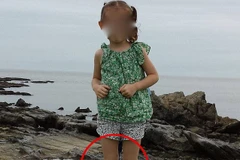 Tiết lộ sốc từ cha của cô bé trong bức ảnh xuất hiện “đôi chân ma” 