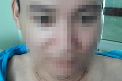 Bệnh nhân Huỳnh Thanh Hùng được phẫu thuật ung thư tuyến giáp. (Ảnh: Đinh Văn Nhiều/TTXVN)