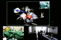 Bệnh viện đa khoa Xanh Pôn thực hiện thành công 4 ca ghép thận