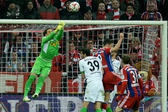 Pep Guardiola: Neuer không có lỗi, Bayern có vấn đề về tấn công