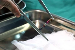 Một ca phẫu thuật tại bệnh viện Sản nhi Bắc Ninh. (Ảnh: Đinh Văn Nhiều/TTXVN)