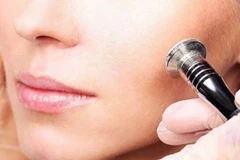 8 bí quyết dành cho người đang đau đầu vì mụn đầu trắng