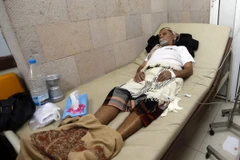Bệnh nhân nhiễm tả điều trị tại một bệnh viện ở Sana’a. (Nguồn: AFP/TTXVN)