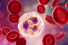 Phát hiện tế bào 'điệp viên hai mang' trong ung thư não