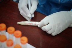 COVID-19: Tỉnh Hậu Giang triển khai cách ly y tế F1 tại nhà