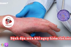 [Audio] Bệnh đậu mùa khỉ nguy hiểm thế nào?