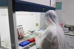 [Video] Bệnh nhân số 91 mắc COVID-19 phải can thiệp ECMO