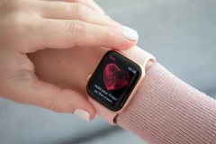 Đồng hồ thông minh Apple Watch cứu mạng một phụ nữ Mỹ