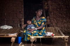 Trẻ em nhiễm sốt rét tại Muma, Cộng hòa dân chủ Congo. (Nguồn: AFP/TTXVN)