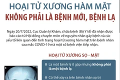 [Infographics] Kết luận về tình trạng hoại tử xương hàm mặt