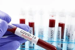 Các nhà khoa học thuộc trường Y khoa Stanford của Mỹ thành công trong thử nghiệm phát hiện các kháng thể chống lại virus SARS-CoV-2 gây dịch COVID-19. (Nguồn: Getty Images/TTXVN) 