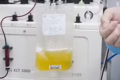 Huyết tương của bệnh nhân mắc COVID-19 đã được chữa khỏi, tại Vũ Hán, tỉnh Hồ Bắc, Trung Quốc, ngày 17/2/2020. (Nguồn: THX/TTXVN) 
